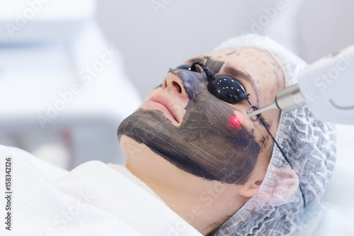 Cuadros en Lienzo Process of photothermolysis, warming the skin, laser carbon peeling