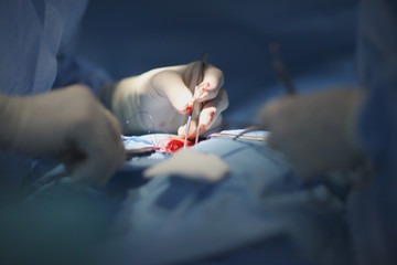 Wall Mural - The doctor at work. During a surgical operation.