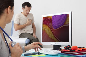 Wall Mural - Models On screen, drawing representing an artery obstructed following a stenosis caused by the compression of the tumor