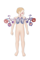 Wall Mural - Depiction of a healthy bronchial tube (left) and a bronchial tube during an asthma attack (right)