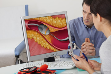 Sticker - Models On screen, illustration of a rotational atherectomy by rotablator Rotablator pulverizing the calcified plaque of atheroma Here, example of a coronary artery