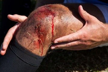 Close up of rugby player with injured knee