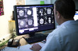 © RF BSIP - Radiologist examining the brain scans on monitor