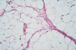Breast tissue section, microscopic image