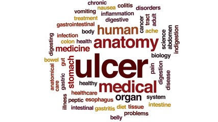 Wall Mural - Ulcer animated word cloud, text design animation.