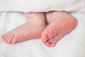 legs of a newborn with peeling skin on a white background closeup