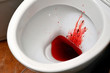 A white ceramic toilet bowl is stained with blood. The consequences of pronounced menstruation, dysbacteriosis, dysentery, haemorrhoids, cancer and other diseases with similar symptoms