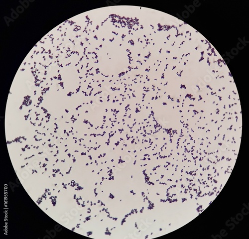 Smear Of Gram Positive Cocci Bacteria Under 100X Light Microscope 