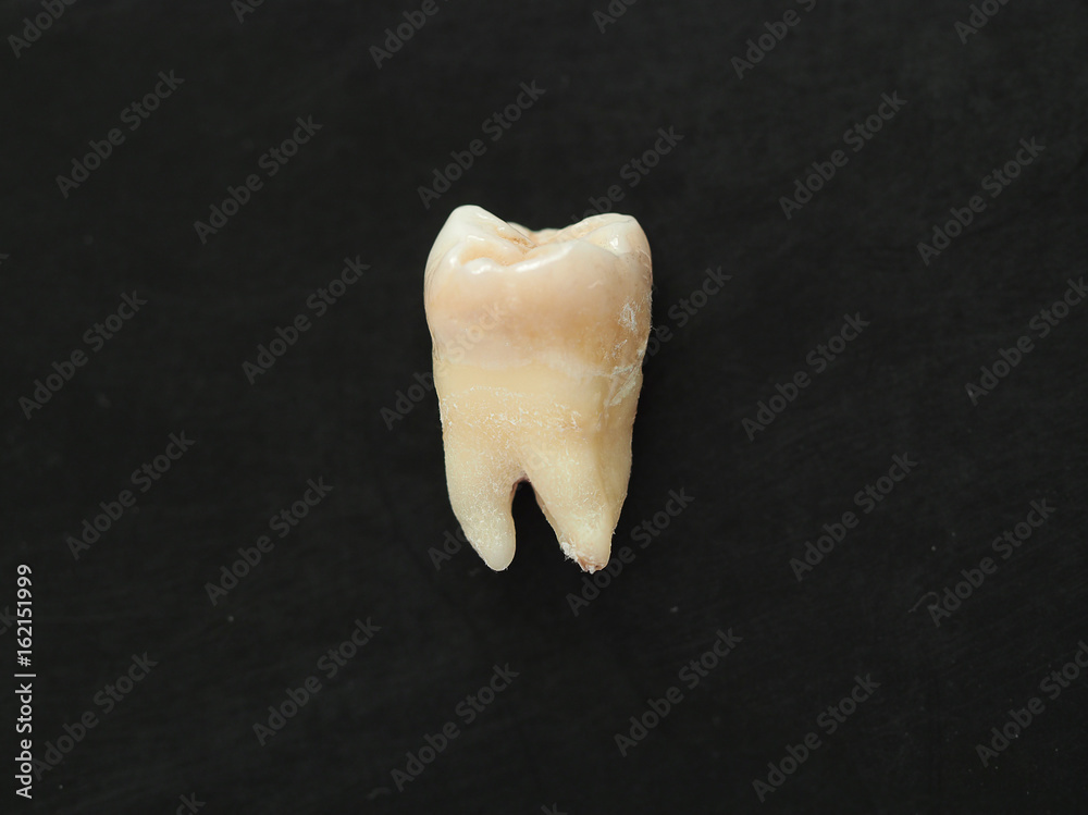 Closeup single real tooth on black background. healthy teeth. Stock ...