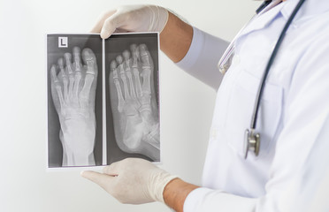 Wall Mural - X ray Image of both human hands,Doctor examining a lung radiography, Doctor looking chest x-ray film,Anatomy.