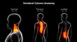 Human Skeleton Vertebral Column Anatomy (Cervical, Thoracic, Lumbar Vertebrae)
