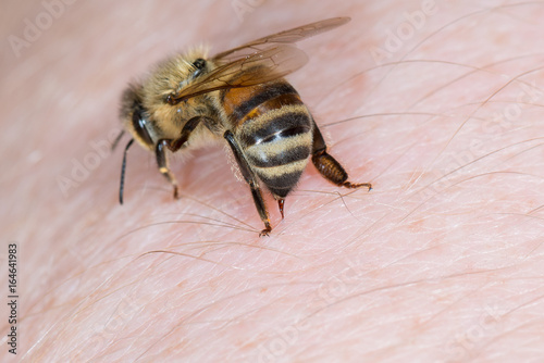 Zdjęcie XXL Pszczoła miodna (Apis mellifera) użądliła się w dłoni