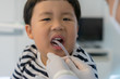 © No-Te - A boy teeth whitening and fluoride treatment