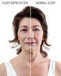 Mature woman before and after exhaustion caused by sleep deprivation on white background