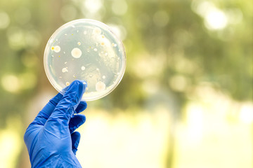 Sticker - Hand of scientist holding petri plate with bacteria on agar