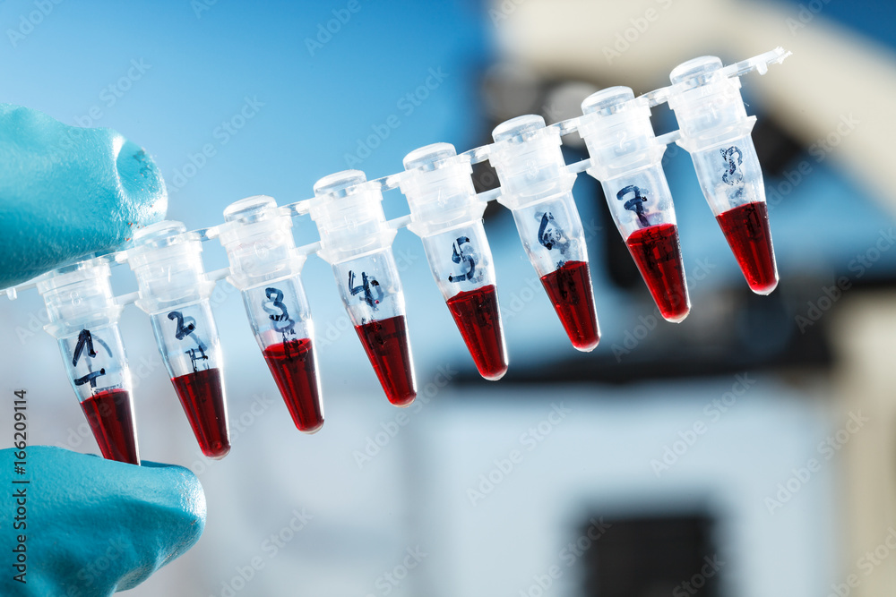 PCR items in laboratory Stock Photo | Adobe Stock