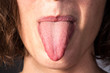 © Alessandro Grandini - Very long tongue out of mouth to verify candica infection