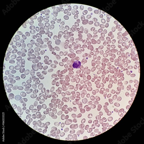 Get Wallpaper Human Blood Smear With Abnormal Red Blood Cells Morphology Call Stomatocyte And White Blood Cell Call Basophils Under 100x Light Microscope Buy This Stock Photo And Explore Similar Images At Adobe Desktop Wallpaper