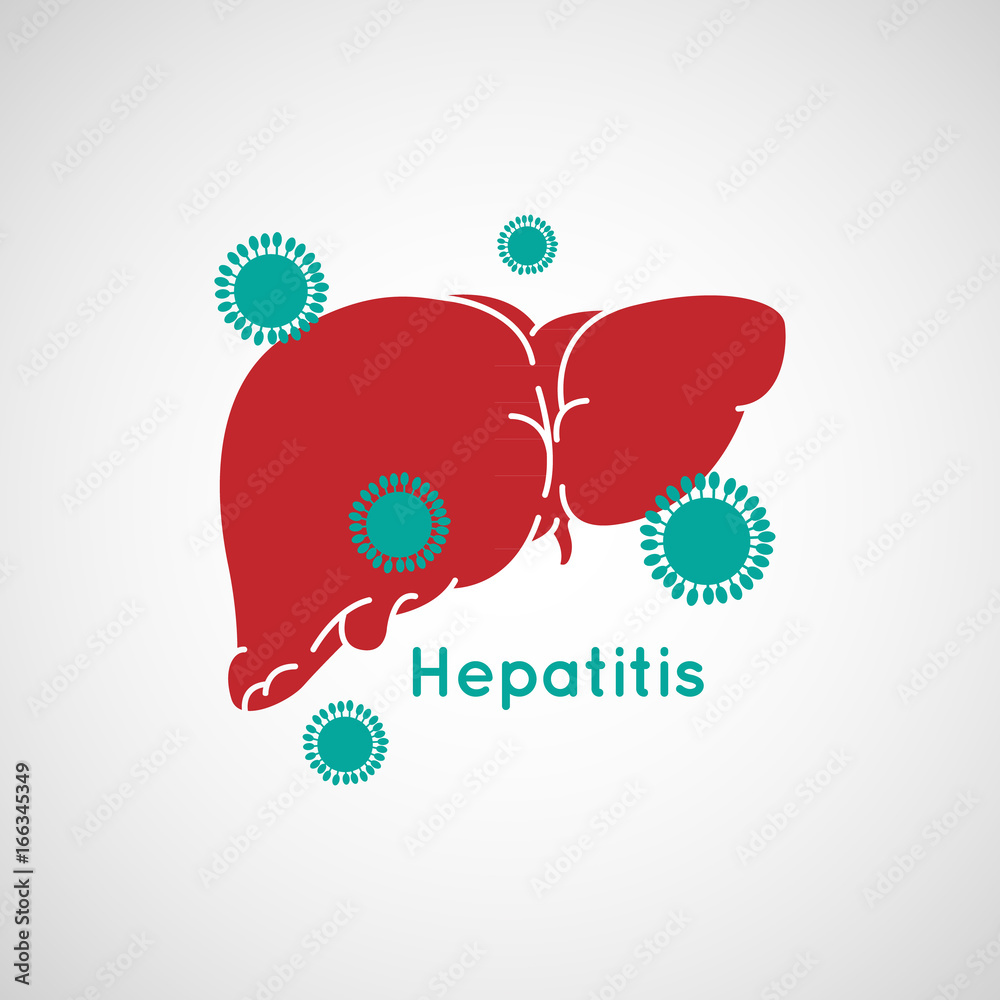 Vector illustration of Hepatitis - obrazy, fototapety, plakaty 