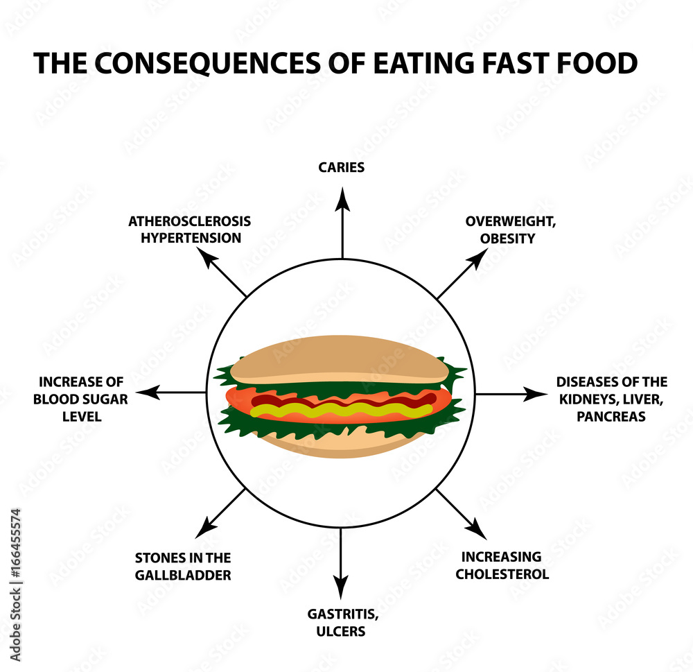 The harmful effect of fast food on the human body. Infographics. Vector  illustration on isolated background Stock Vector | Adobe Stock