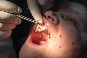 Wall Mural - The dentist works with the client in the clinic