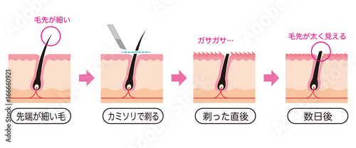 ムダ毛処理 カミソリ 毛の断面図 Stock Illustration Adobe Stock