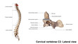 Cervical vertebrae C2_Lateral view