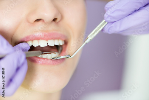 Fotografía Close up dental exam of young girl with crooked teeth