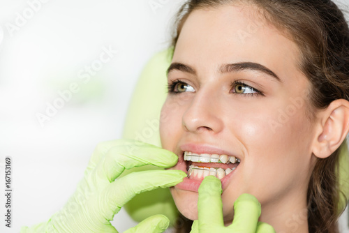 Fotografía Dentist exam. Braces control on young teenage girl teeth