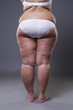 Overweight woman with fat legs and buttocks, obesity female body