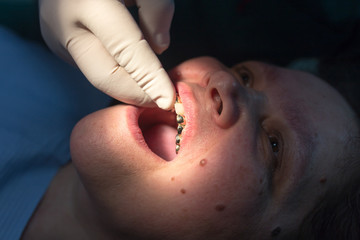 Wall Mural - The dentist works with the client in the clinic