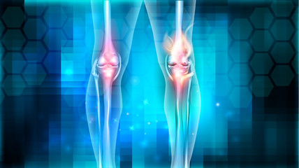 Poster - Joint problems bright abstract design, burning damaged knee 