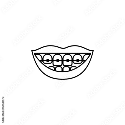 Smiling female lips with braces. Vector line icon isolated on white ...