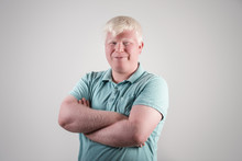 Albino Young Man Portrait. Smiling Man Isolated At White Background