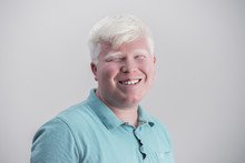 Albino Young Man Portrait. Smiling Man Isolated At White Background