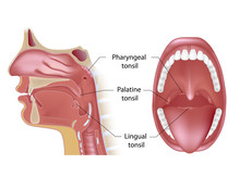 Tonsils In Open Mouth And Sagittal View