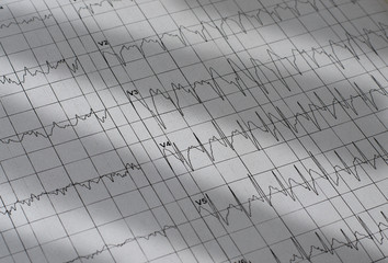 Electrocardiogram chart as medical background