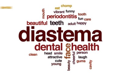 Canvas Print - Diastema animated word cloud, text design animation.