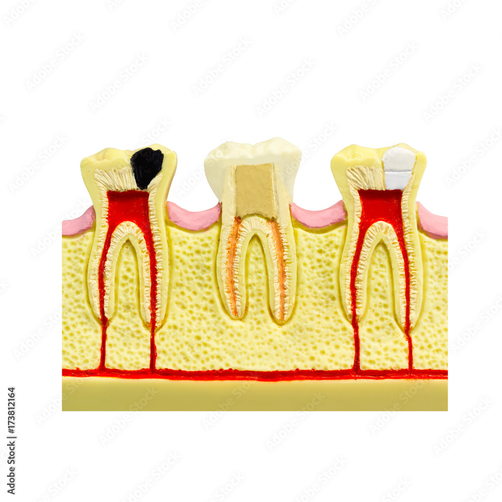 Human tooth gum cross section Tooth Root canal Tooth Detailed anatomy ...
