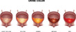 Urine color chart from light yellow till red color. Urinary bladder detailed anatomy and urine inside