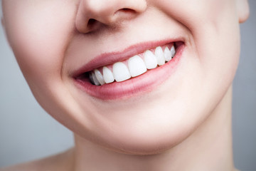 Close-up healthy smile of young woman.