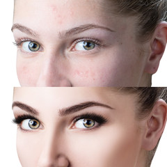 Female eyes before and after eyelash extension