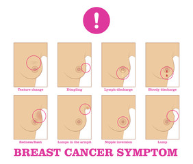 Breast cancer symptom. Warning signs and danger, unusual changes and pain. Information poster. Female healthcare concept. White background vector illustration