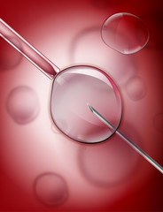 In Vitro Fertilization