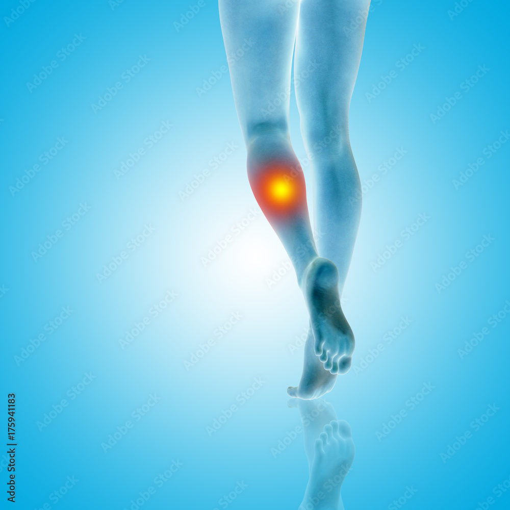 Conceptual beautiful woman or girl legs and feet with a hurt calf pain or ache closeup, 3D illustration of human slim fit body medical or health care concept, painful sport injury on blue background