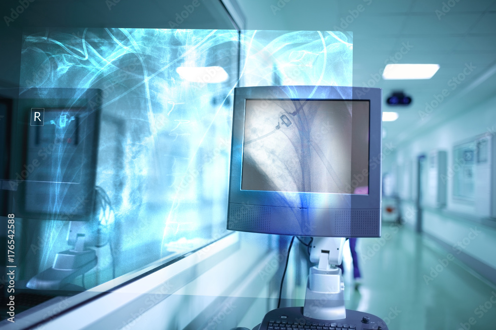 Visual projection of an x-ray image in the hospital Stock Photo | Adobe ...