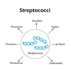 Streptococci. Streptococcal diseases. Infographics. Vector illustration