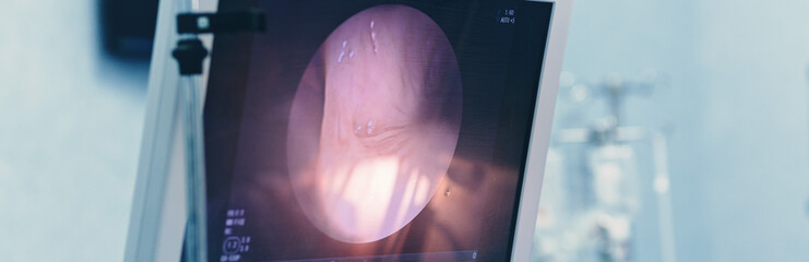 endoscopy examination procedure with endoscope equipment in surgical room endoscopic exam with latest technology