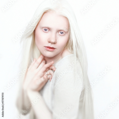 Albino Girl With White Skin Natural Lips And White Hair Photo Face On A Light Background Portrait Of The Head Blonde Girl Kaufen Sie Dieses Foto Und Finden Sie Ahnliche Bilder