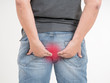 Middle-aged man with hemorrhoids